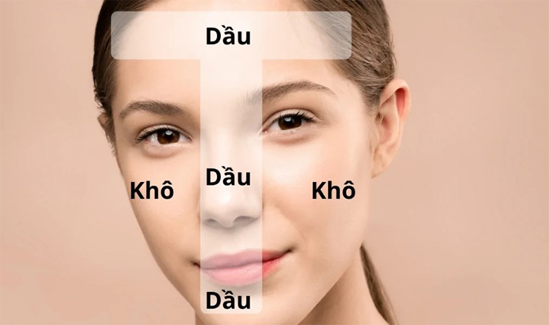 Da hỗn hợp (Combination Skin) và cách chăm sóc Da hỗn hợp